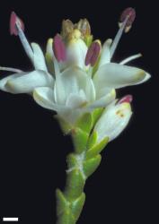 Veronica hectorii subsp. coarctata. Terminal inflorescence of opposite sessile bisexual flowers. Scale = 1 mm.
 Image: W.M. Malcolm © Te Papa CC-BY-NC 3.0 NZ